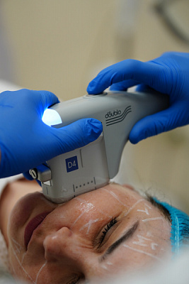 Doublo HIFU SMAS Lifting | UltraSave